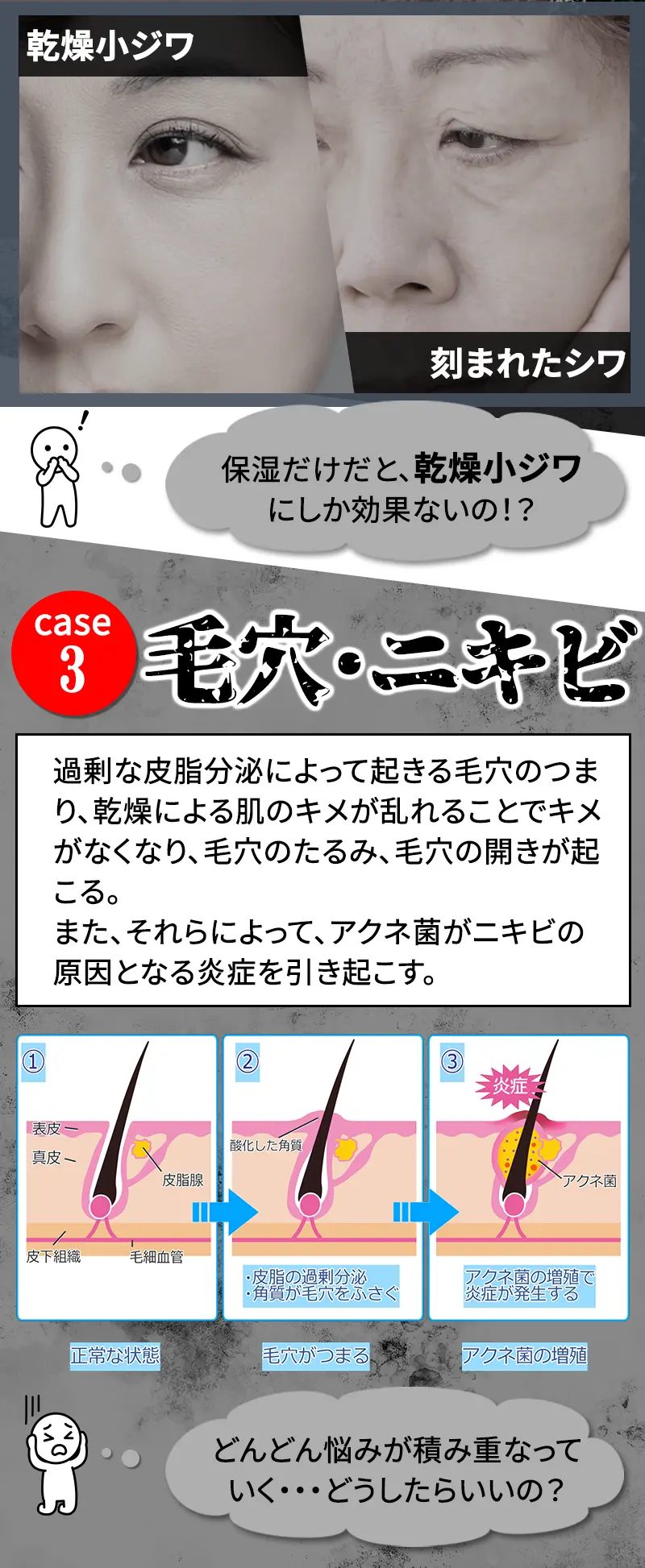 公式】シズカホワイトゲル｜シズカニューヨーク